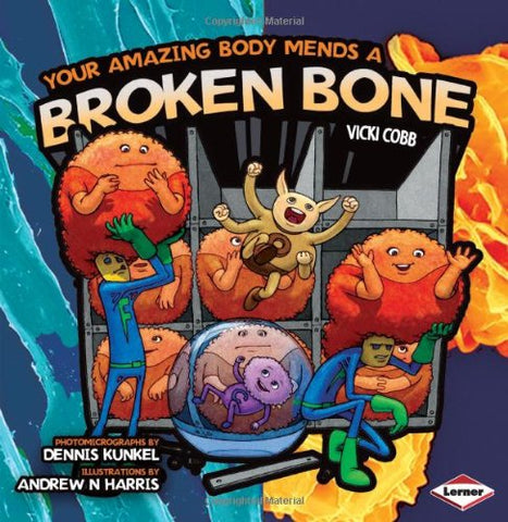Your Amazing Body Mends A Broken Bone